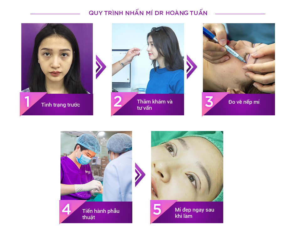 Nhấn mí có đau không